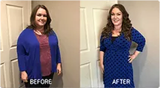 Before and After: Weight Loss