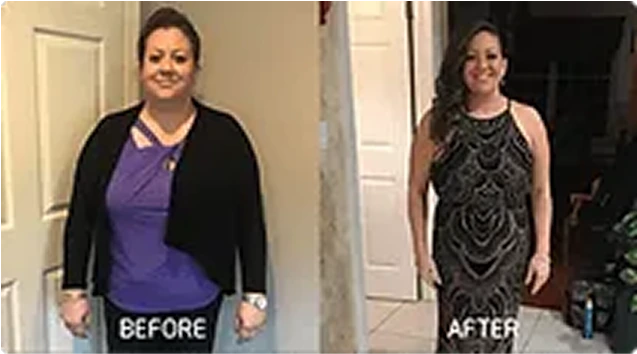 Before and After: Weight Loss d